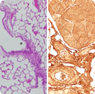 Se establece la relación entre el estrés oxidativo y la pérdida de masa muscular