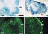 Identificat un gen essencial per  a  la formació del  cerebel